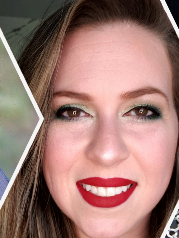 Frownies. The No-Tox Solution.